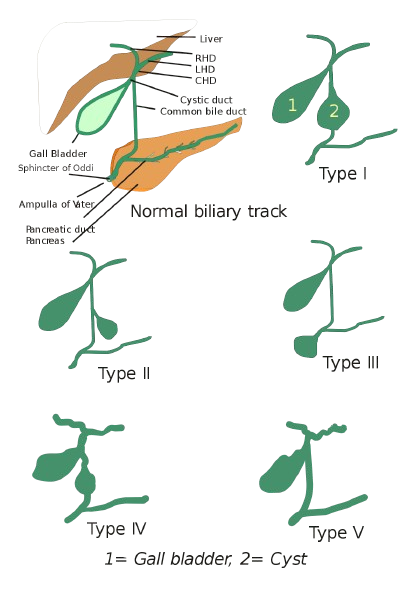 Types Of Gall Bladder Cancer​ Image