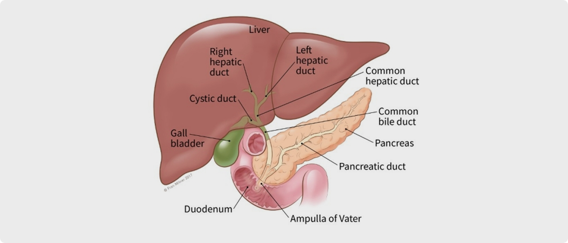 Bile Duct Cancer Image