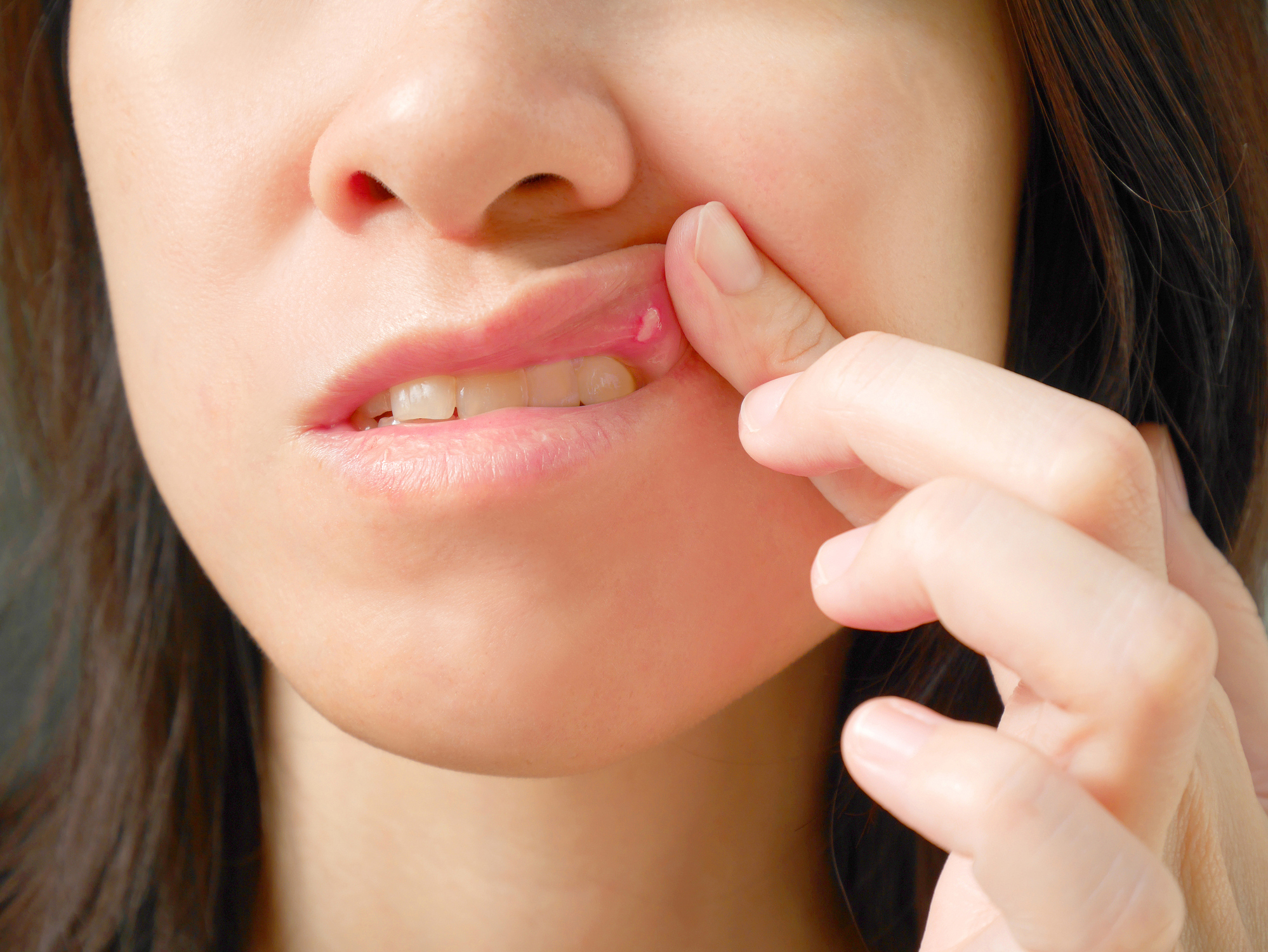 Oral Cancer Treatments and Management​