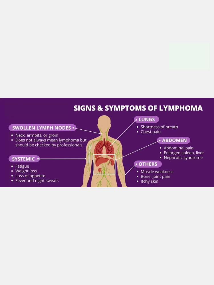 Causes Of Lymphoma Cancer Image