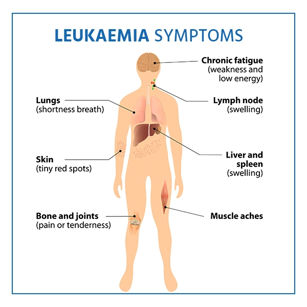 Leukemia Cancer Diagnosis​ image