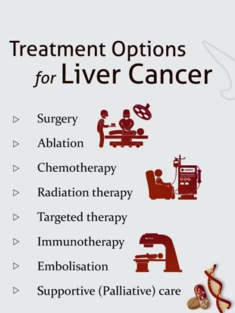 Liver Cancer Treatments Image