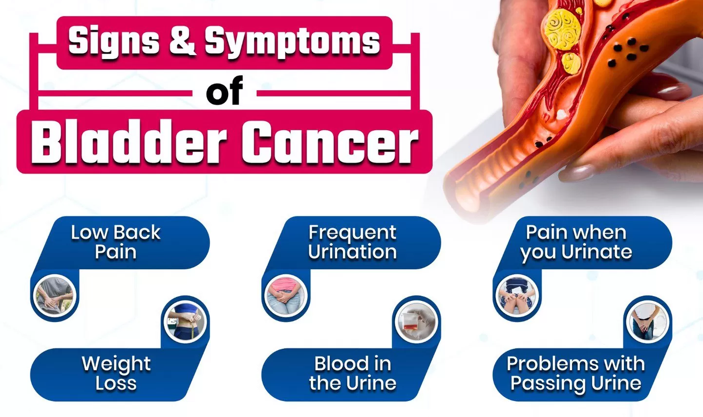 Symptoms Of Bladder Cancer Image