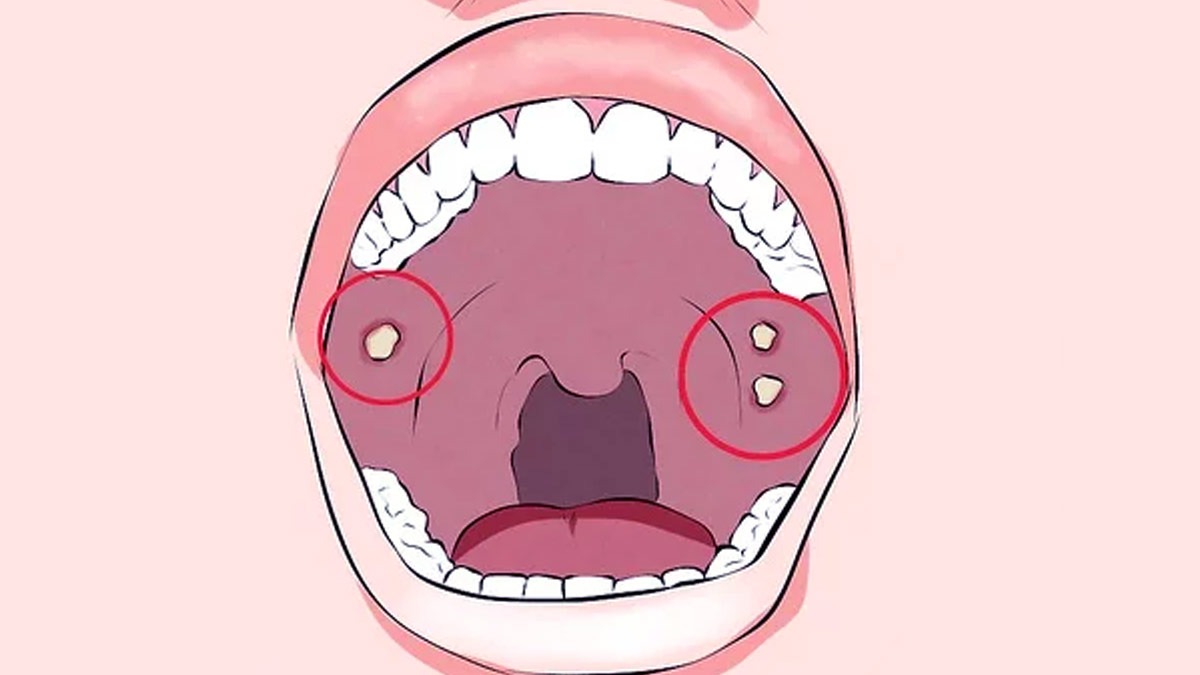 Diagnosis of Oral Cancer​