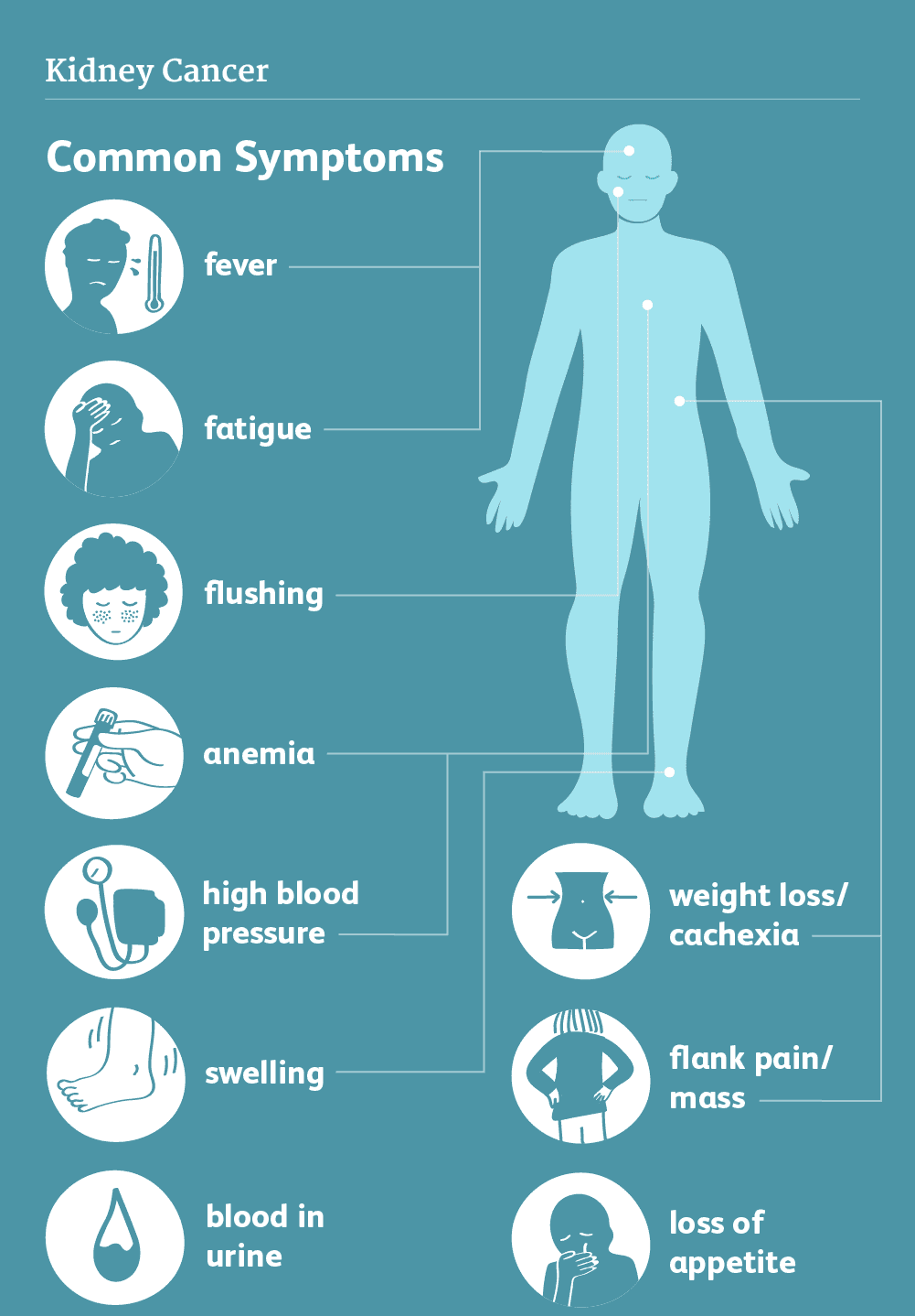 Symptoms of Kidney Cancer Image