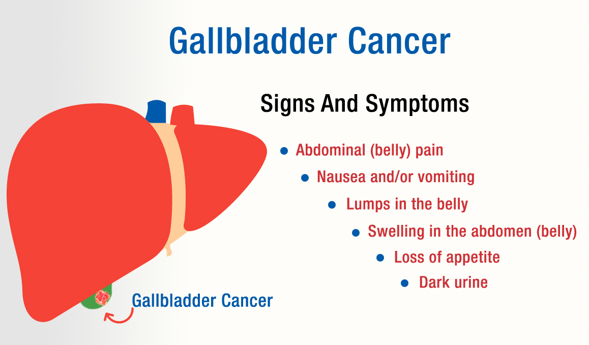 Symptoms Of Gall Bladder Cancer​ Image